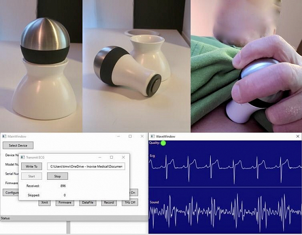 Photo 1 - Automatic, analytics of heart QT, rhythm and sounds.